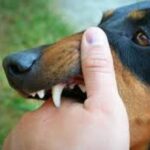 Madariaga: Un perro que ingresó a una casa, ataco brutalmente a una mujer y le amputaron un dedo