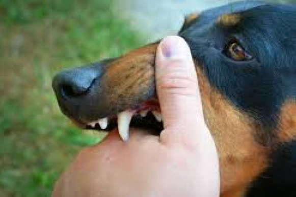 Madariaga: Un perro que ingresó a una casa, ataco brutalmente a una mujer y le amputaron un dedo